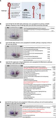 ER stress mediates Angiotensin II-augmented innate immunity memory and facilitates distinct susceptibilities of thoracic from abdominal aorta to aneurysm development